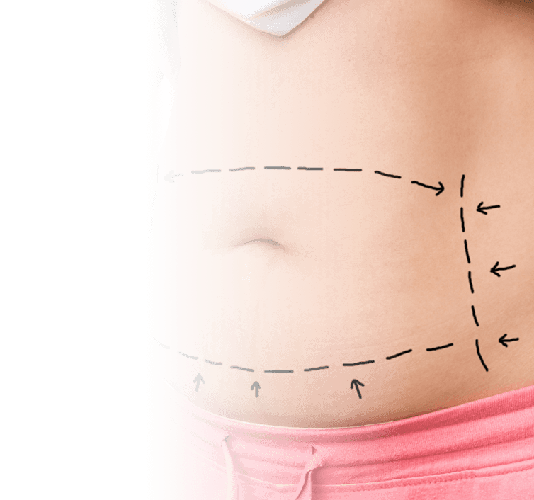 Abdominoplasty Frequently Asked Questions and Answers - Mansfield Cosmetic  Surgery Center